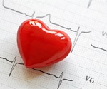 El uso más frecuente de cannabis se asocia con un mayor riesgo de enfermedad de las arterias coronarias